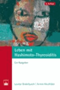 Leben mit Hashimoto-Thyreoiditis - Ein Ratgeber.