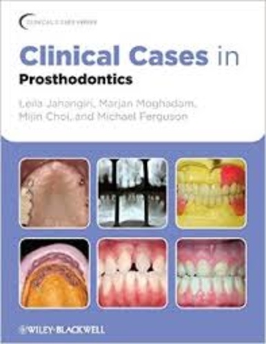 Leila Jahangiri et Marjan Moghadam - Clinical Cases in Prosthodontics.