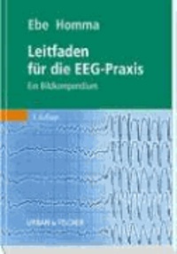 Leitfaden für die EEG-Praxis - Ein Bildkompendium.