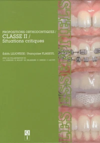 Propositions orthodontiques classe II