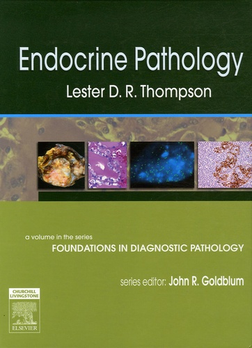 Lester DR Thompson et John R. Goldblum - Endocrine Pathology - Edition en langue anglaise.