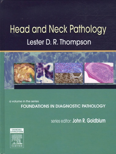 Lester DR Thompson - Head and Neck Pathology.