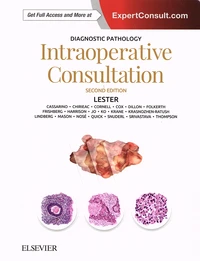 Intraoperative Consultation