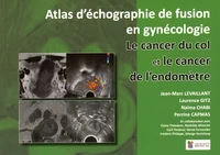 Le cancer du col et le cancer de l'endomètre