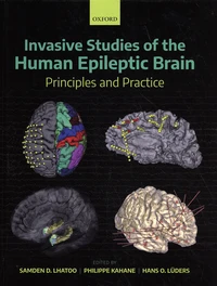 Invasive Studies of the Human Epileptic Brain