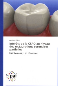 Anthony Falco - Intérêts de la CFAO au niveau des restaurations coronaires partielles - Les inlays-onlays en céramique.
