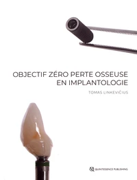 Objectif zéro perte osseuse en implantologie