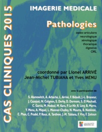 Ebook francais téléchargement gratuit Imagerie médicale  - Pathologies ostéo-articulaire, neurologique, sénologique, thoracique, digestive, ORL 9782840239901