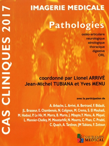Lionel Arrivé et Jean-Michel Tubiana - Imagerie médicale - Pathologies ostéoarticulaire, neurologique, sénologique, thoracique, digestive, ORL.