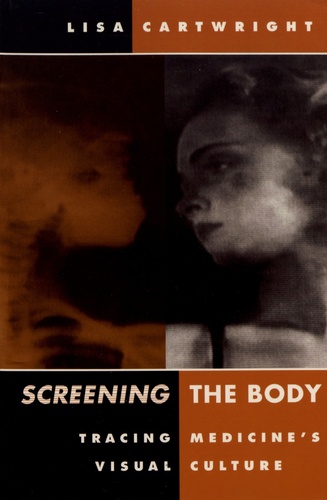Screening the Body. Tracing Medicine's Visual Culture