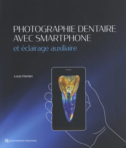 Photographie dentaire avec smartphone et éclairage auxiliaire