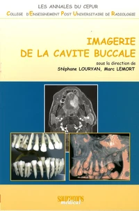 Imagerie de la cavité buccale