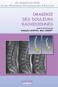 Imagerie des douleurs rachidiennes