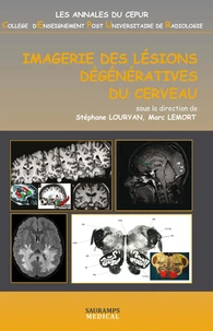 Imagerie des lésions dégénératives du cerveau