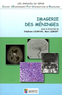 Imagerie des méninges