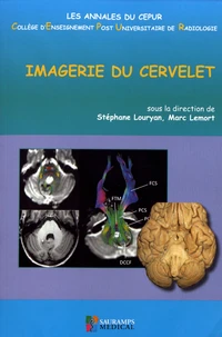 Imagerie du cervelet