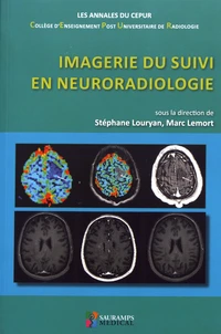 Imagerie du suivi en neuroradiologie