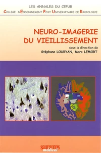 Neuro-imagerie du vieillissement