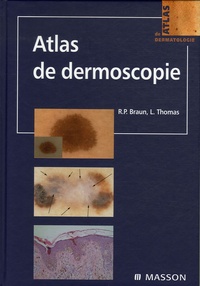 Luc Thomas et Ralph-P Braun - Atlas de dermoscopie.