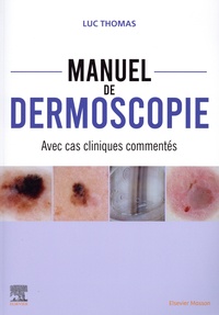 Luc Thomas - Manuel de dermoscopie - Avec cas cliniques commentés.