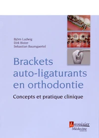 Brackets auto-ligaturants en orthodontie