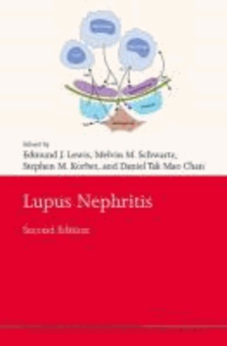 Lupus Nephritis.