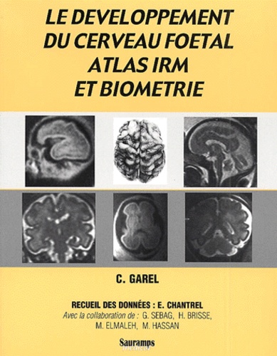 M Elmaleh et G Sebag - Le Developpement Du Cerveau Foetal : Atlas Irm Et Biometrie.