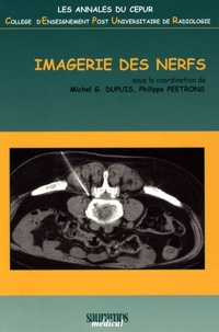 M. G. Dupuis et Philippe Peetrons - Imagerie des nerfs.