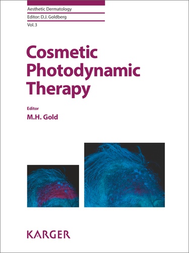M-H Gold - Cosmetic Photodynamic Therapy.