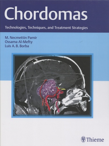 Chordomas. Technologies, Techniques, and Treatment Strategies