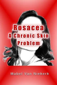 Rosacea – A Chronic Skin Problem
