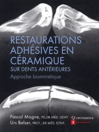 Restauration adhésives en céramique sur dents antérieures