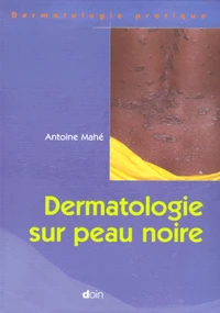 Dermatologie Sur Peau Noire