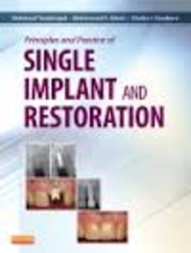 Mahmoud Torabinejad et Mohammad A. Sabeti - Principles and Practice of Single Implant and Restoration.