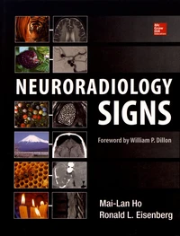 Neuroradiology Signs