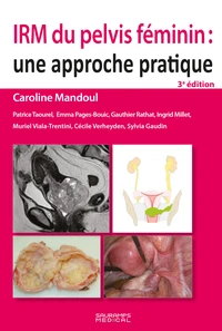 IRM du pelvis féminin
