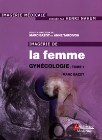 Imagerie de la femme : gynécologie