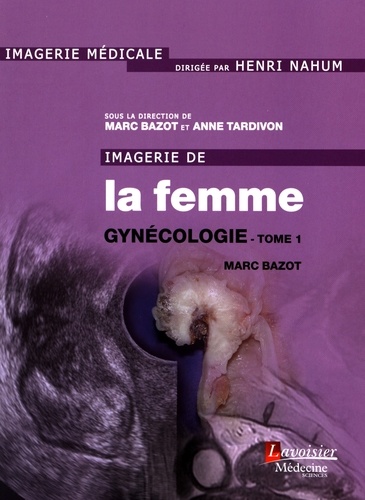 Marc Bazot et Anne Tardivon - Imagerie de la femme : gynécologie - Tome 1.