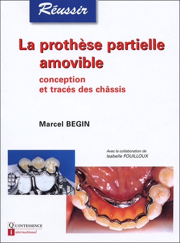 Marcel Begin - La prothèse partielle amovible - Conception et tracés des châssis.