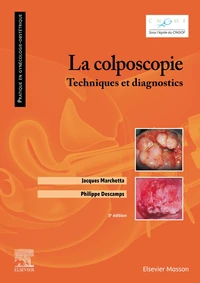 La colposcopie