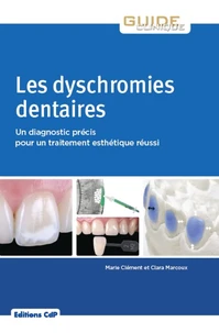 Les dyschromies dentaires