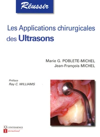 Les applications chirurgicales des ultrasons