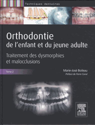 Orthodontie de l'enfant et du jeune adulte. Tome 2, Traitement des dysmorphies et malocclusions