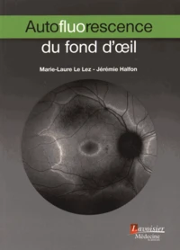 Autofluorescence du fond d'oeil