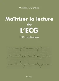 Maîtriser la lecture de l'ECG