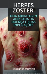 Herpes zoster: Uma abordagem ampliada sobre a doença e suas implicações