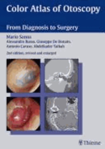 Mario Sanna - Color Atlas of Otoscopy - From Diagnosis to Surgery.