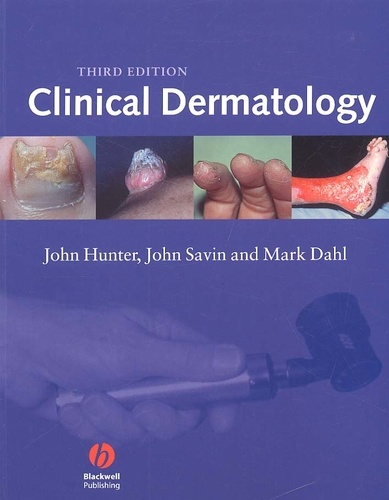 Mark Dahl et John Hunter - Clinical Dermatology. 3rd Edition.