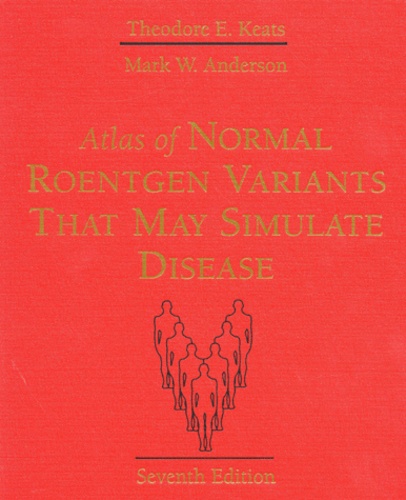 Mark-W Anderson et Theodore-E Keats - Atlas Of Normal Roentgen Variants That May Simulate Disease. 7th Edition.