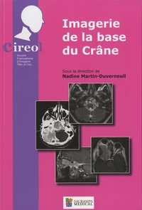 Imagerie de la base du crâne